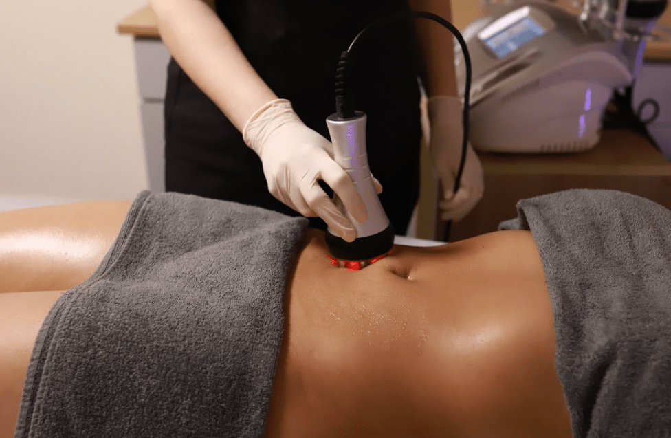 Is Radiofrequency Skin Tightening Treatment Right for Me? - MovMore Clinic