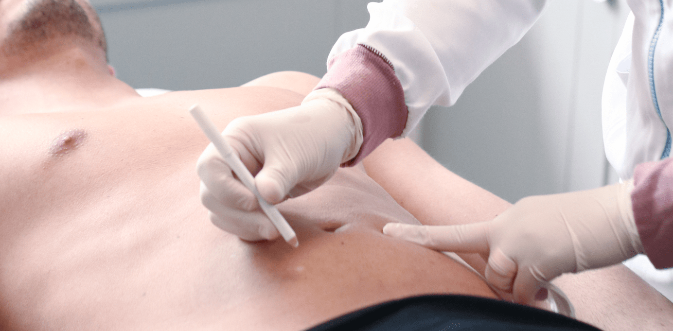 Everything To Know About Fat Dissolving Treatments (Injection Lipolysis) - MovMore Clinic