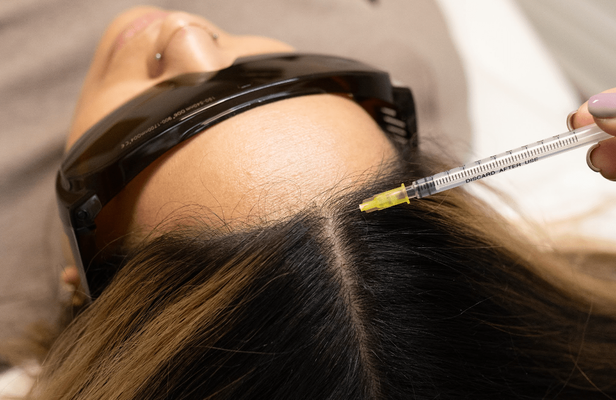 Hair Mesotherapy: Everything You Need to Know - MovMore Clinic