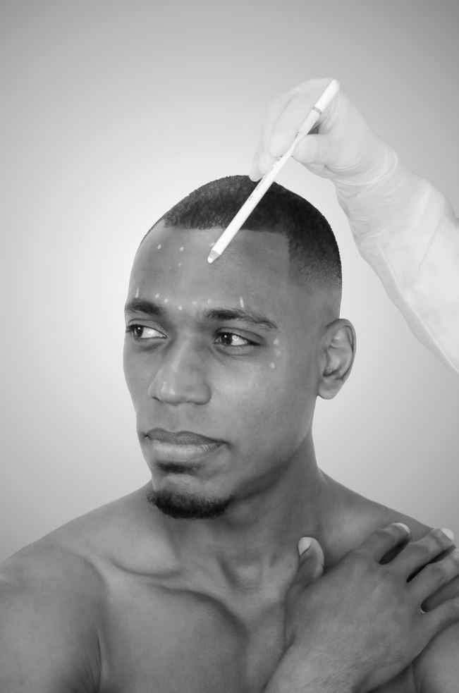 Skinbooster - Mov More Clinic