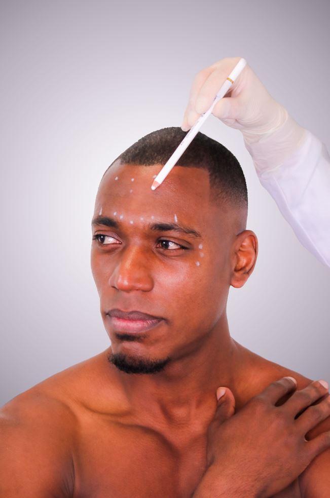 Skinbooster - Mov More Clinic