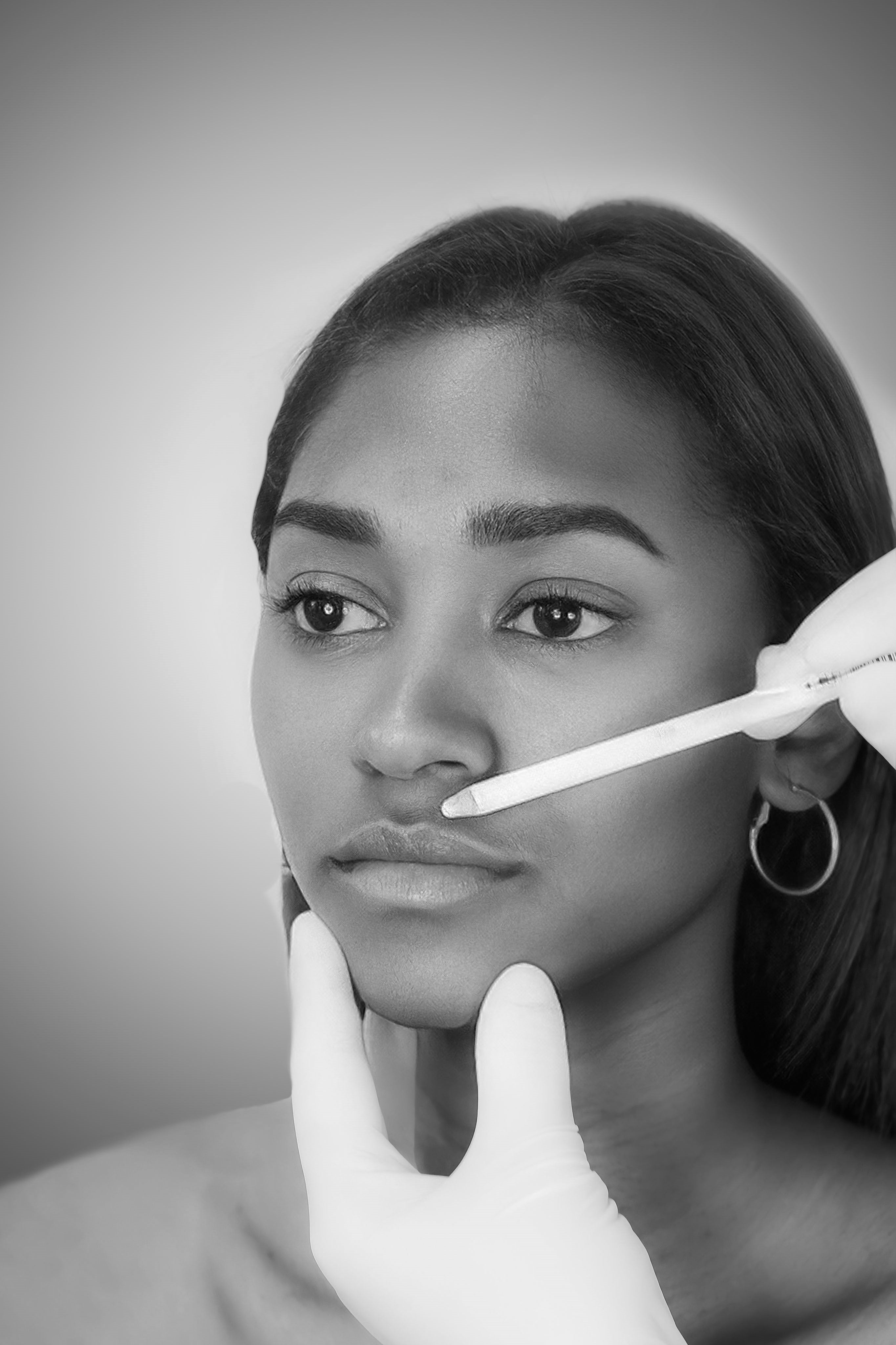 Lip Filler - Mov More Clinic