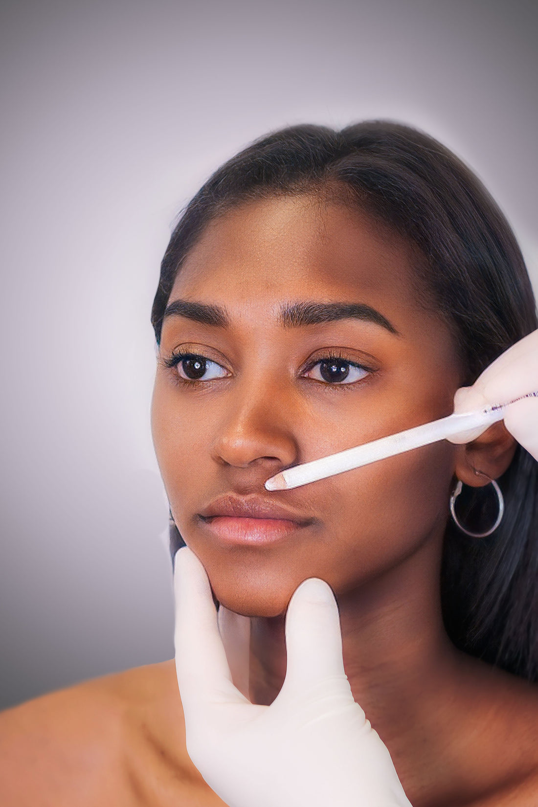Lip Filler - Mov More Clinic