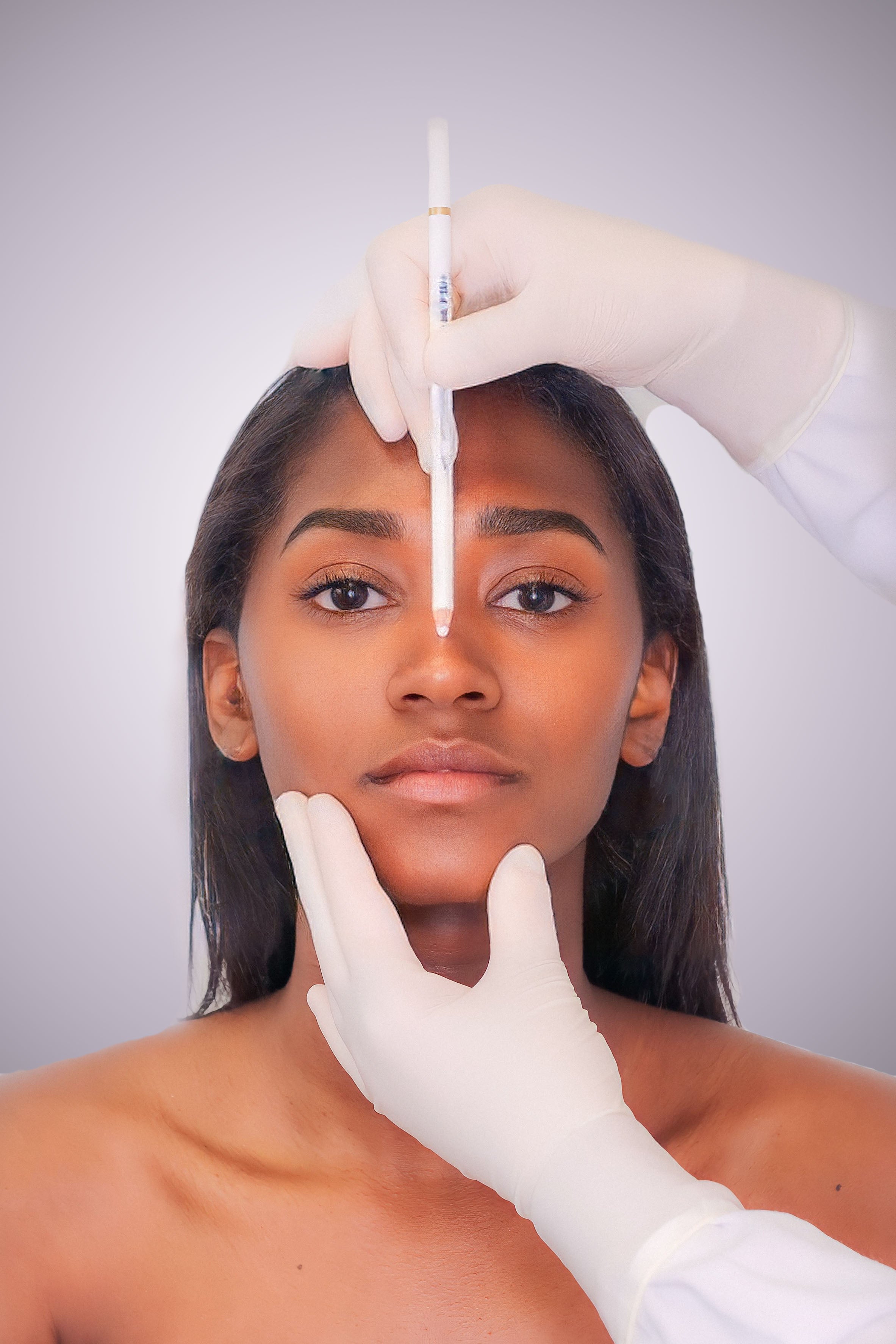 Nose Fillers - Non - Surgical Rhinoplasty - Mov More Clinic