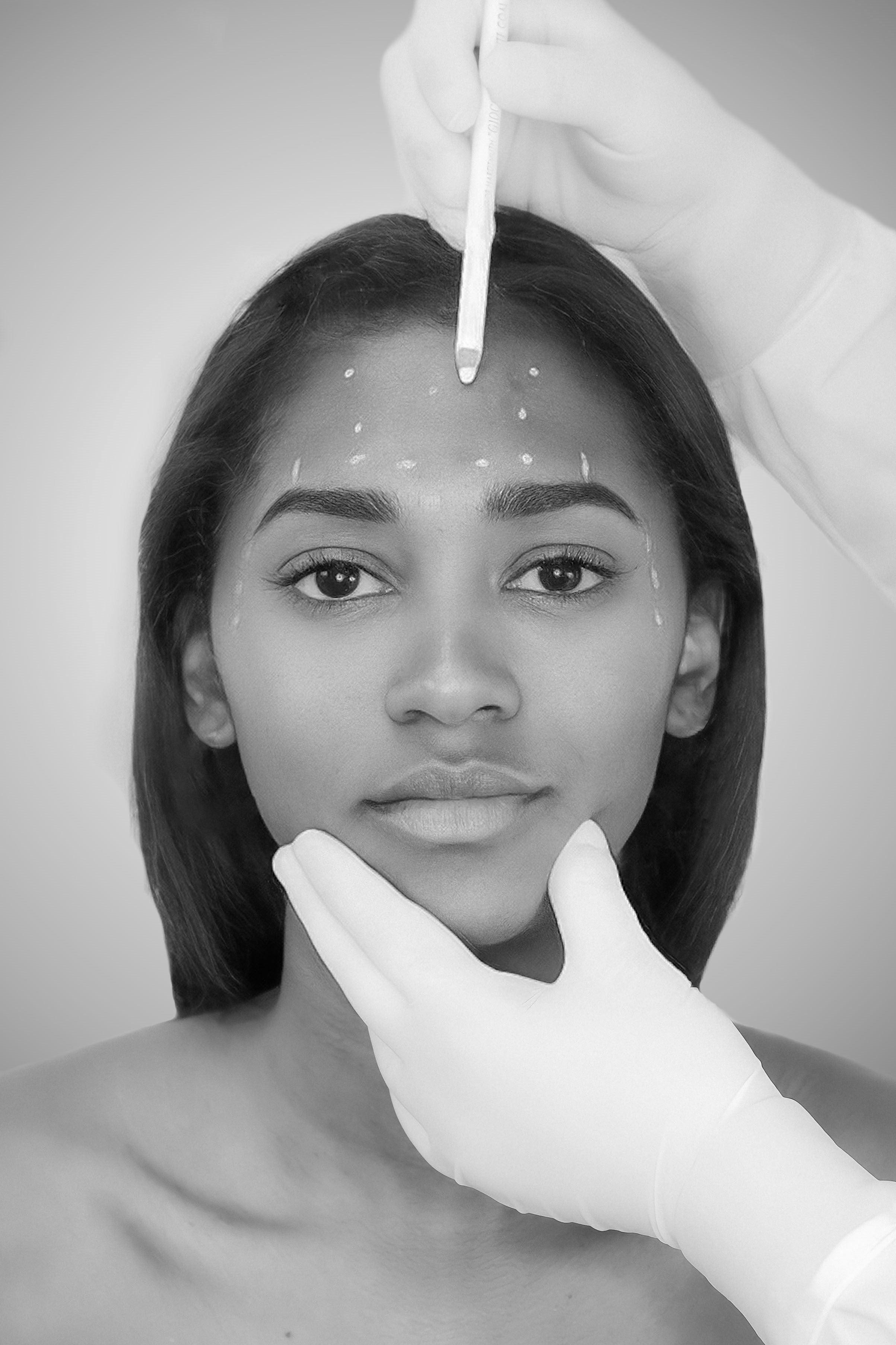 Anti - Wrinkles - 3 Areas - Mov More Clinic