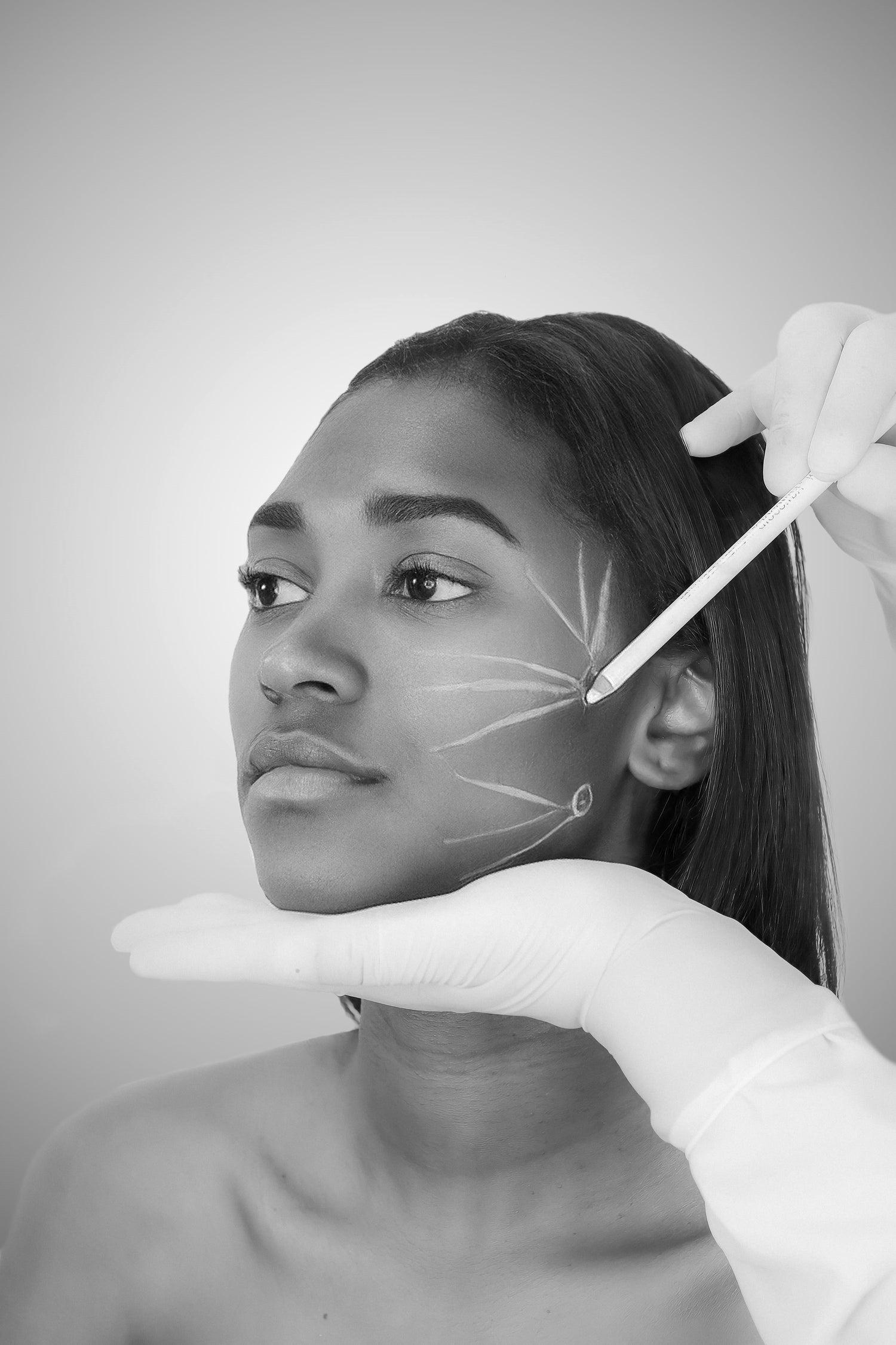 Under - Eye Filler - Mov More Clinic