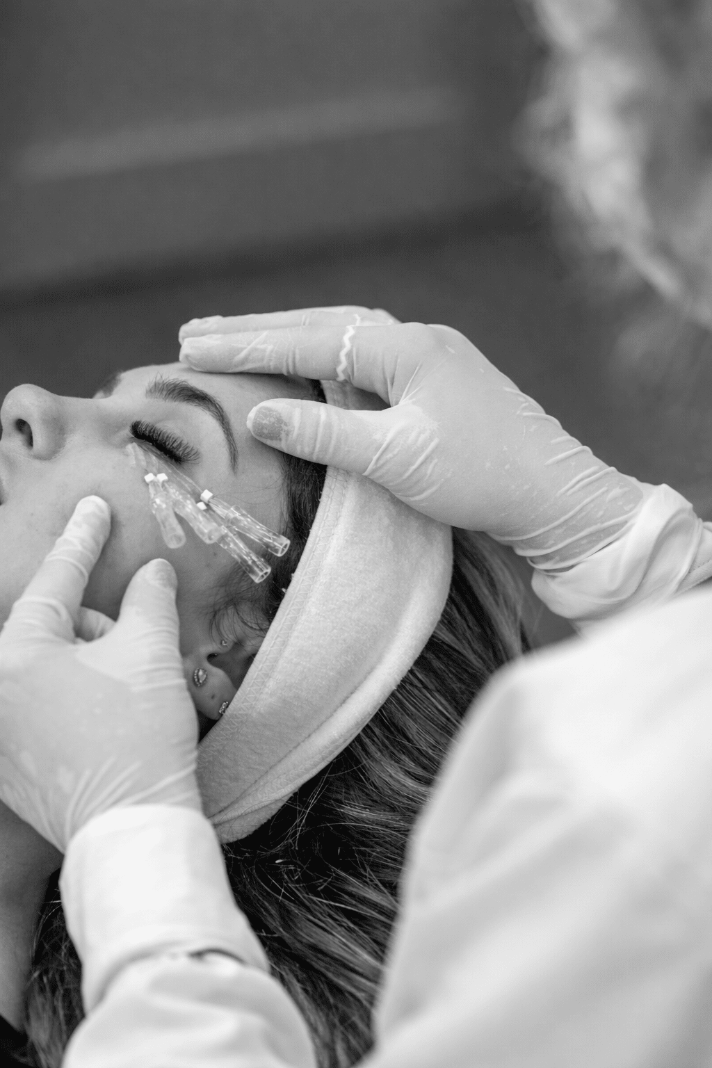 PDO Threads - MovMore Clinic