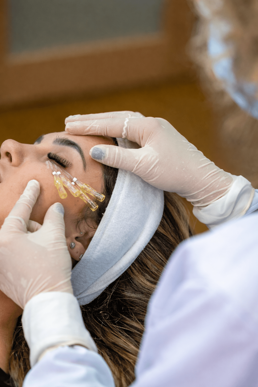 PDO Threads - MovMore Clinic