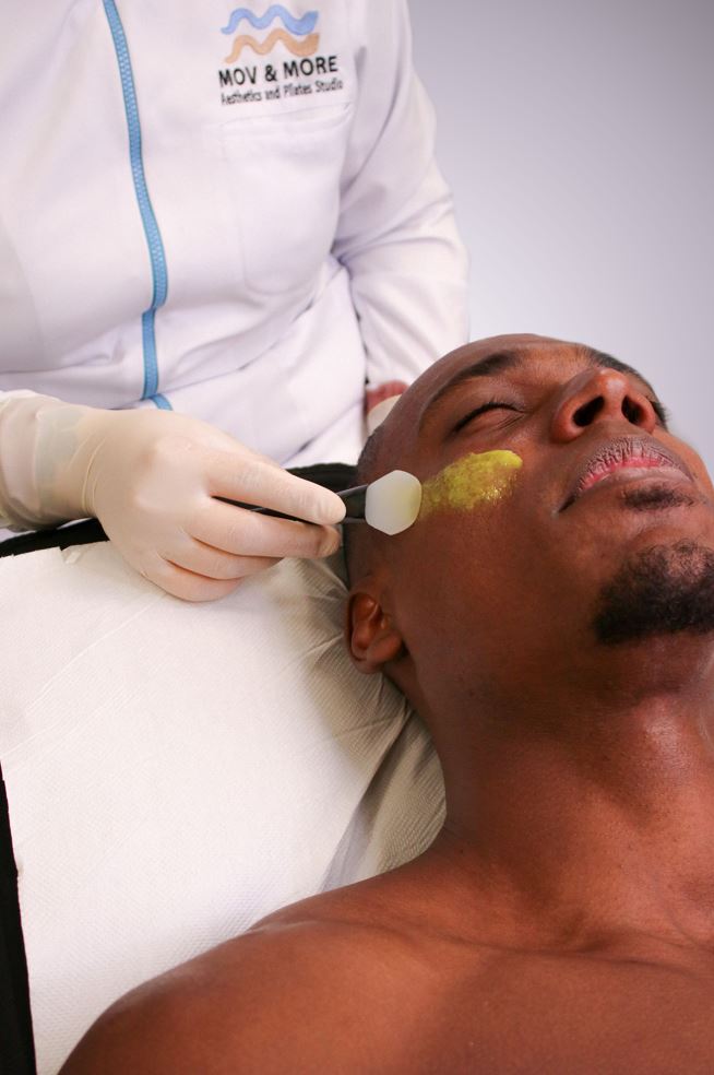 Chemical Peels (Consultation Fee) - Mov More Clinic
