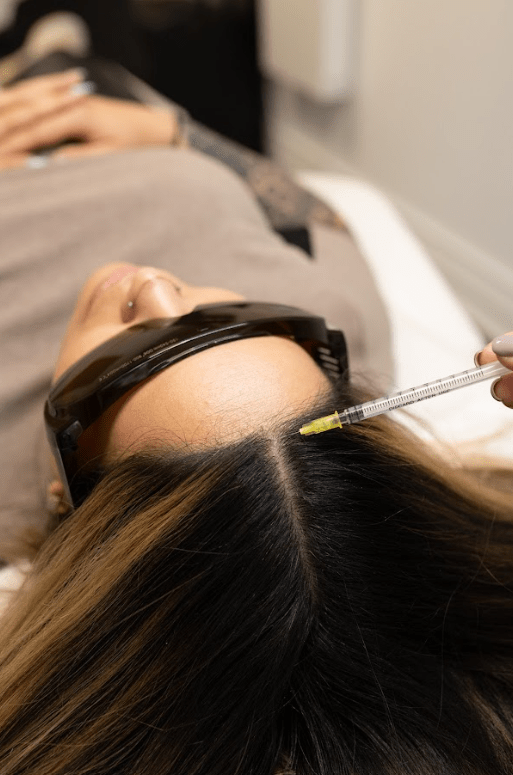 Hair Mesotherapy - Mov More Clinic