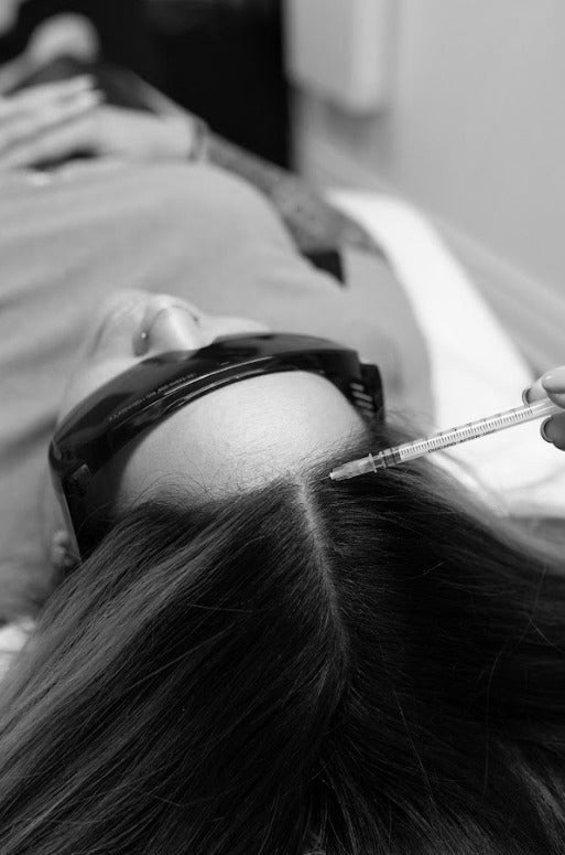 Hair Mesotherapy - Mov More Clinic