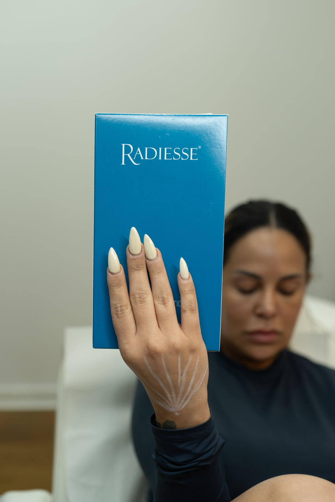 Radiesse - MovMore Clinic
