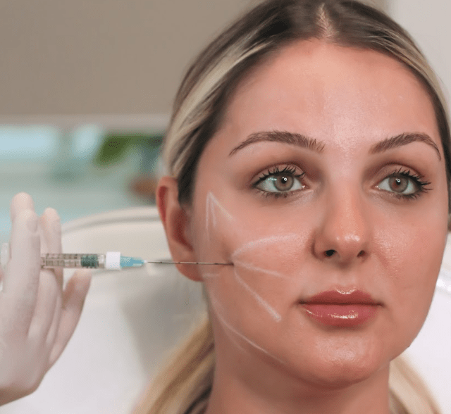 What are Collagen Biostimulators? All You Need to Know - MovMore Clinic