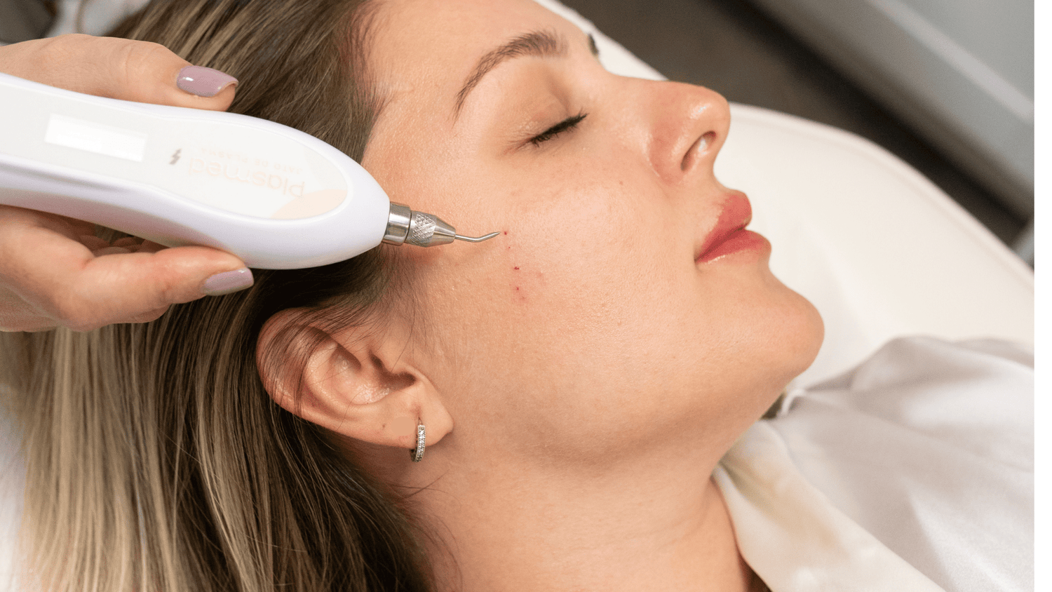 5 Key Benefits of Jet Plasma Treatment for Ageing Skin - MovMore Clinic
