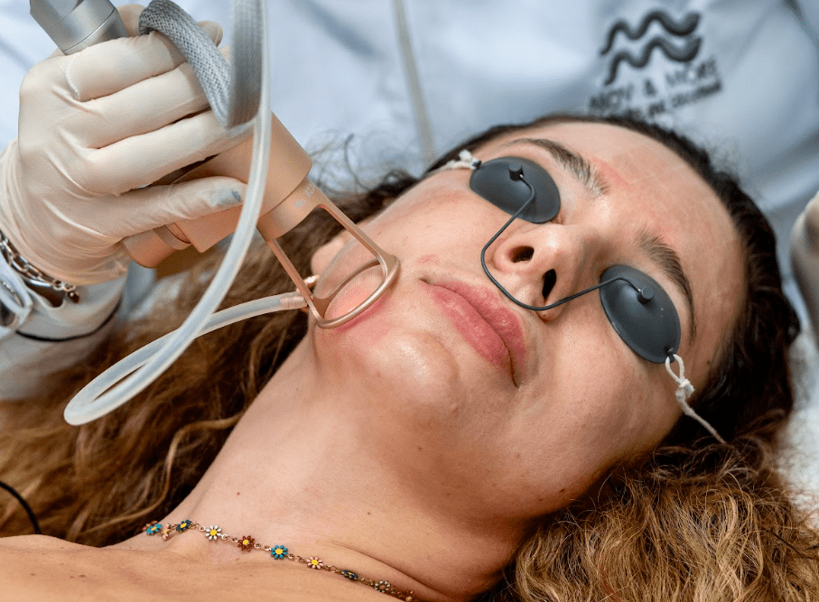 Best Collagen Stimulator Treatments - MovMore Clinic