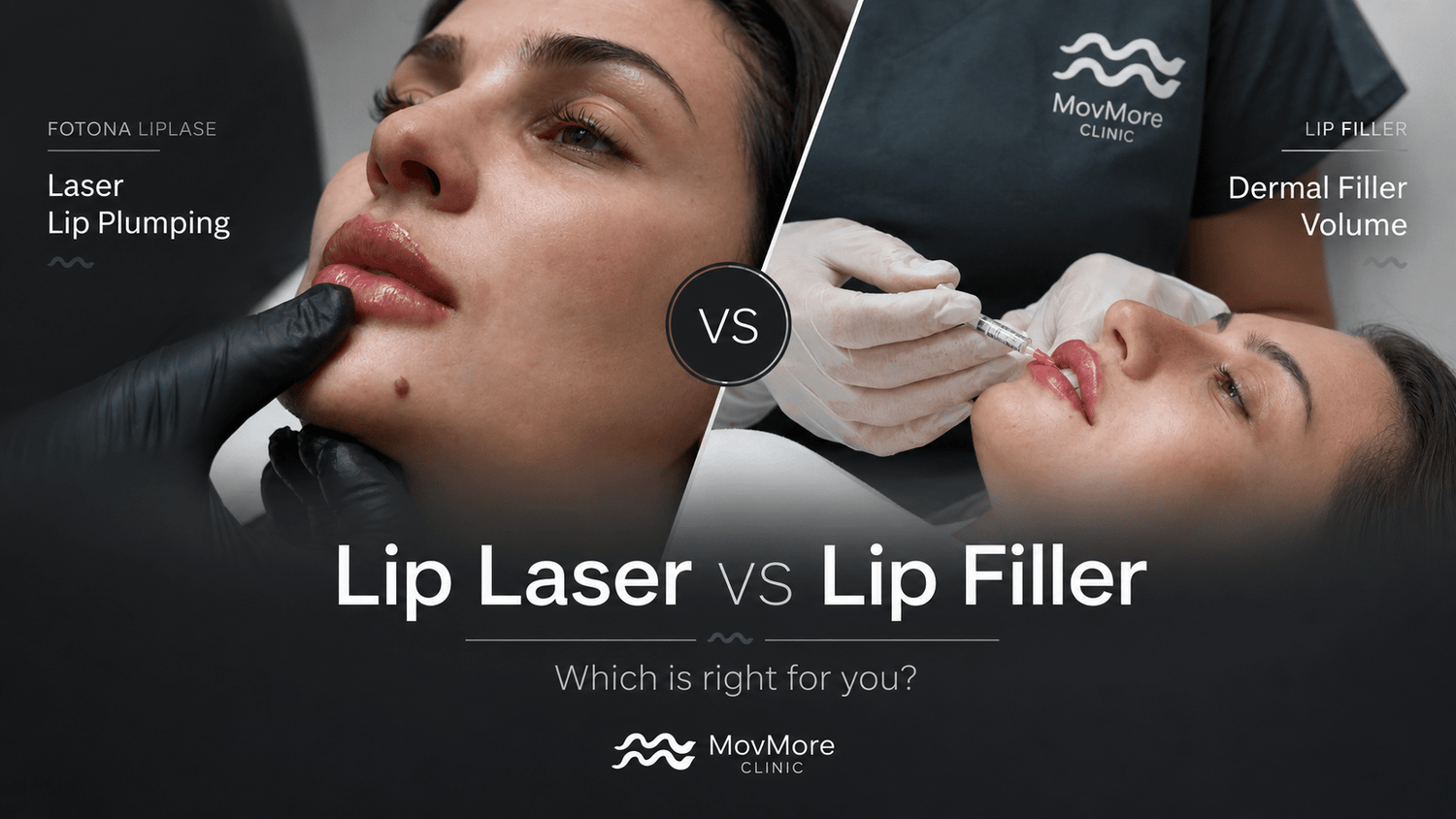 Lip Laser vs Lip Filler: Which Is Right for You? - MovMore Clinic