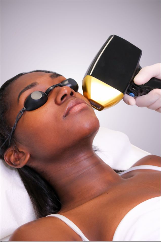 Upper Lip and Chin - Mov More Clinic