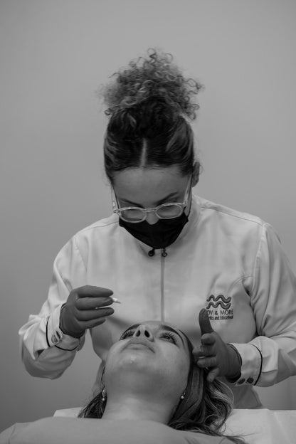Microneedling with PDRN Gold Infusion - MovMore Clinic