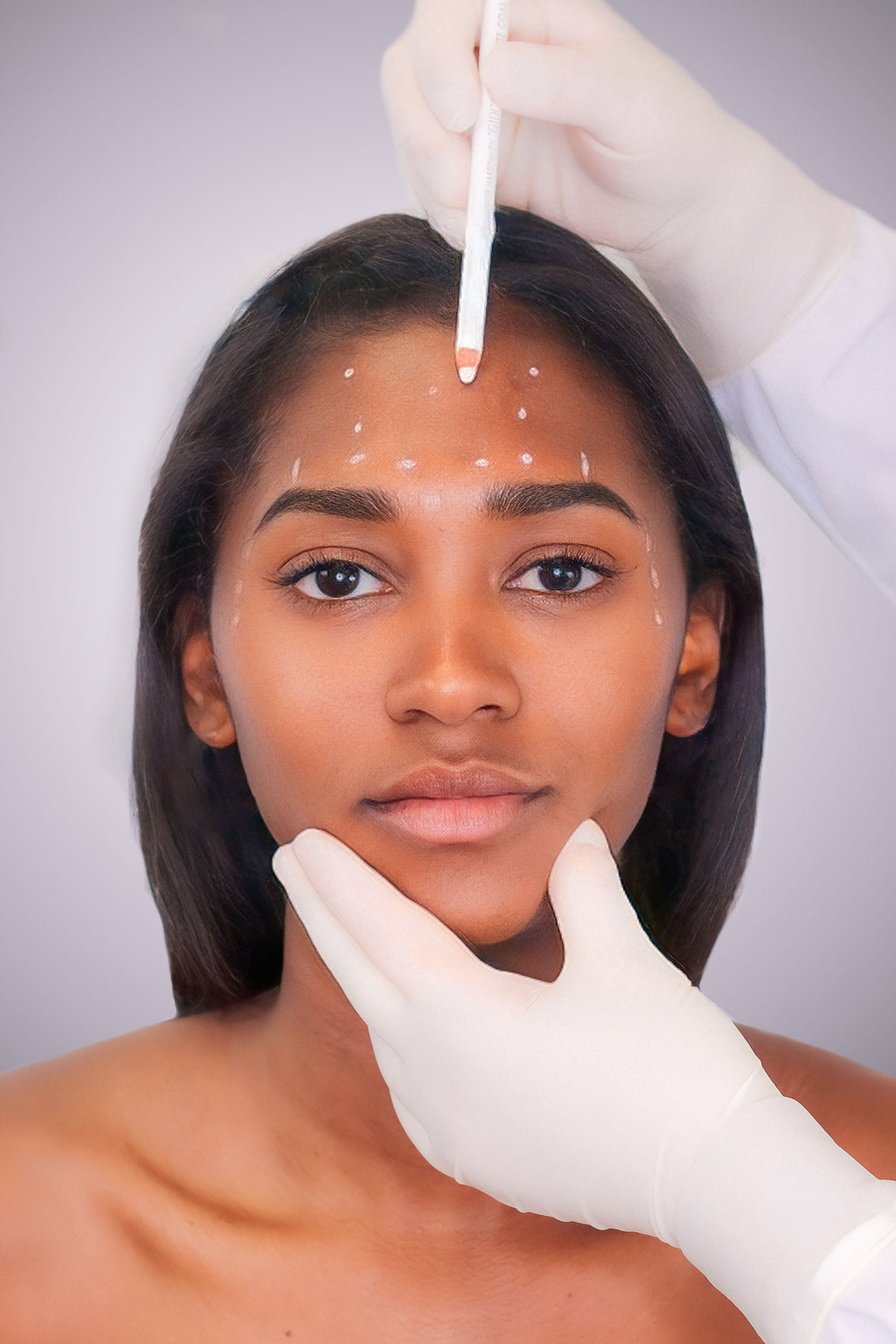 Anti - Wrinkles - 3 Areas - Mov More Clinic