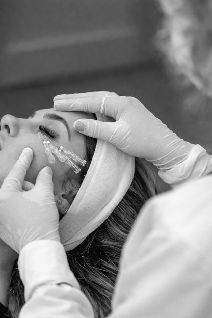 PDO Threads - MovMore Clinic