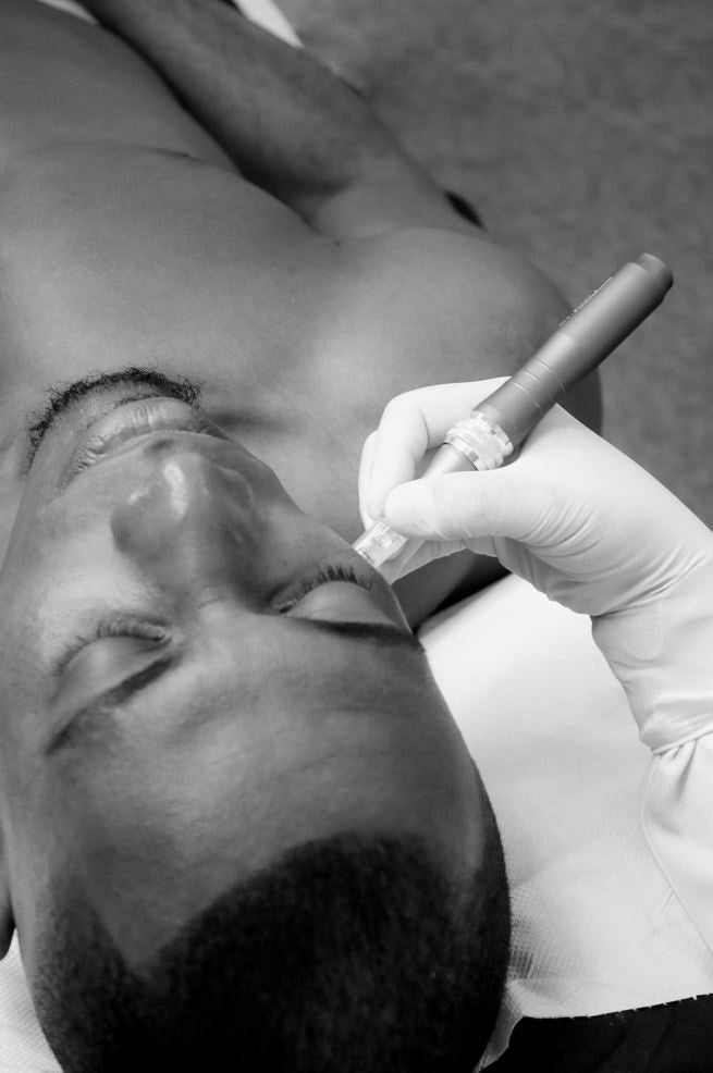 Skin Cleansing with Diamond Peeling - Microdermabrasion - Mov More Clinic